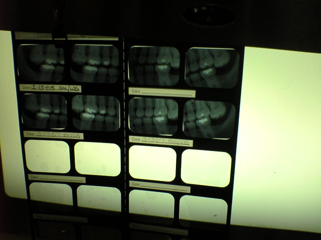 x-rays